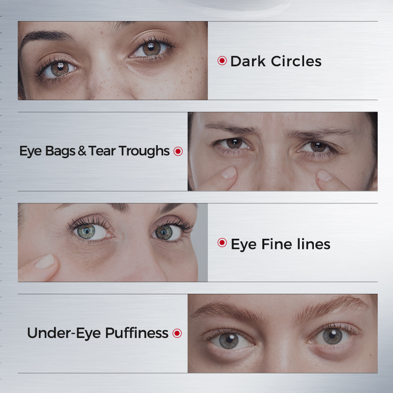 くま用アイパッチ – コラーゲン、アセチルヘキサペプチド-8 - Collagen Eye Patch のレビューと価格
